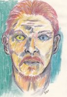 Odd-eyed male with red hair